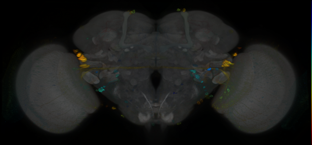 P{GMR93B11-GAL4} expression pattern