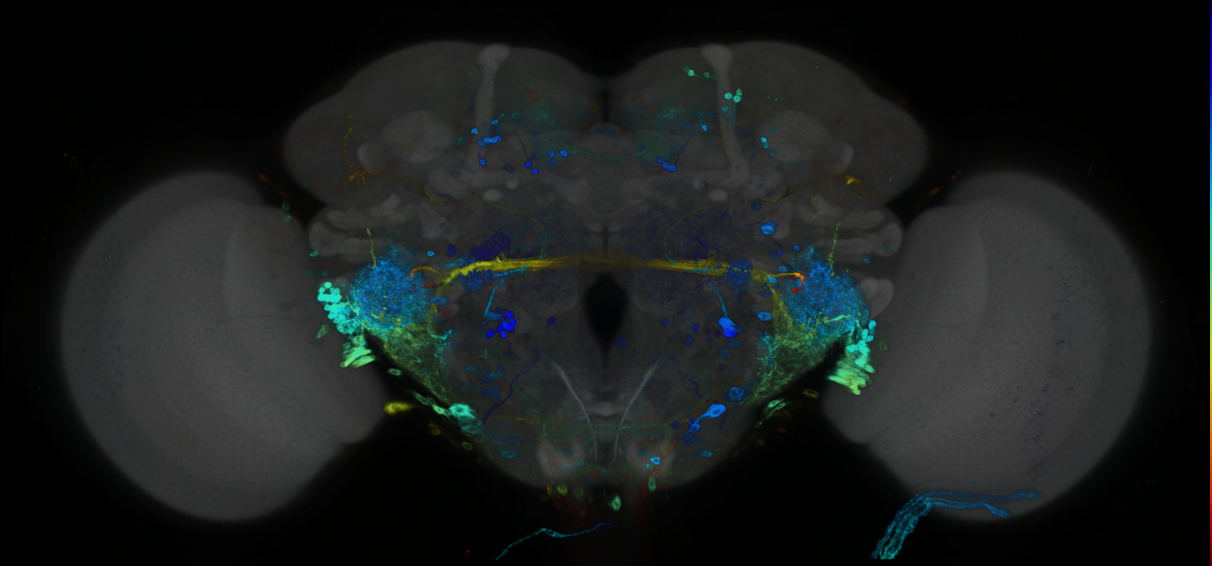 P{GMR93G08-GAL4} expression pattern