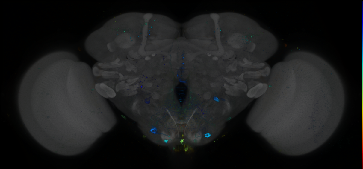 P{GMR93G11-GAL4} expression pattern