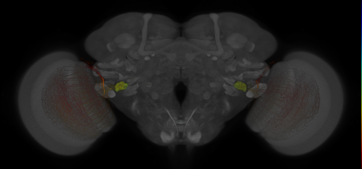 JRC_OL0047B_Brain_2017_20131210_32_E1_63x