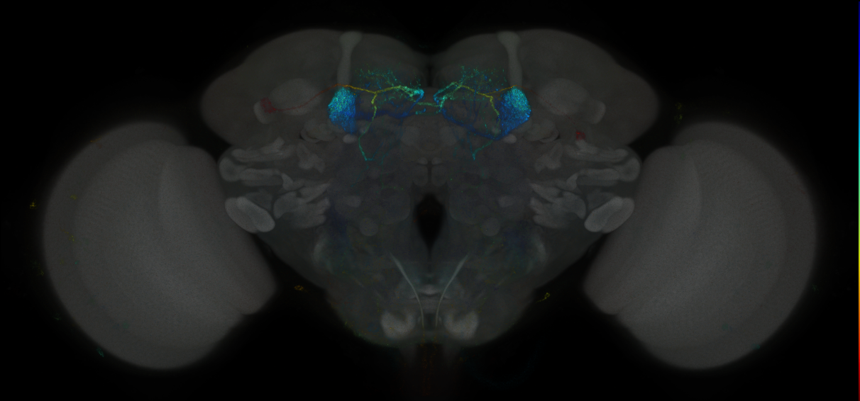 JRC_MB296B_Brain_2014_20121031_31_F2_20x