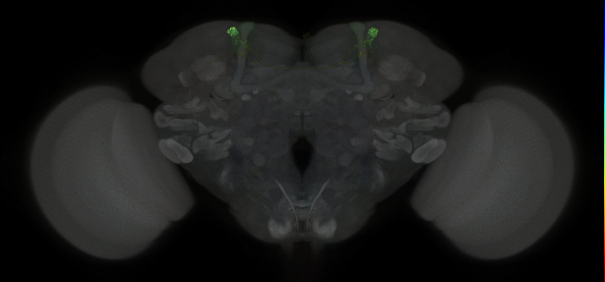 JRC_MB308B_Brain_2014_20121031_31_I1_20x