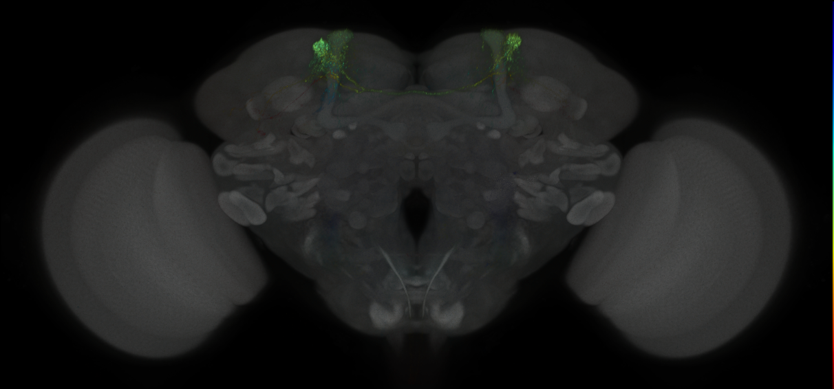 JRC_MB304B_Brain_2014_20121031_31_J1_20x