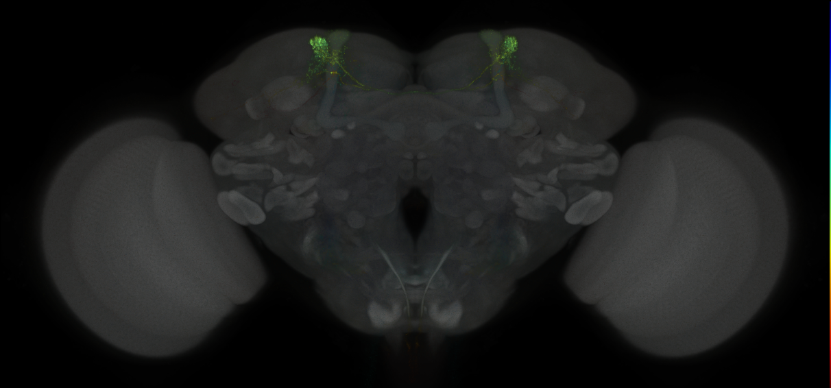 JRC_MB304B_Brain_2014_20121031_31_J2_20x