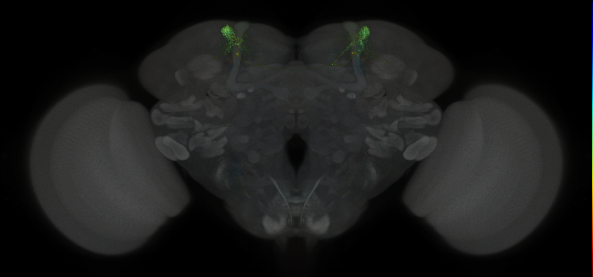 JRC_MB304B_Brain_2014_20121031_31_J3_20x