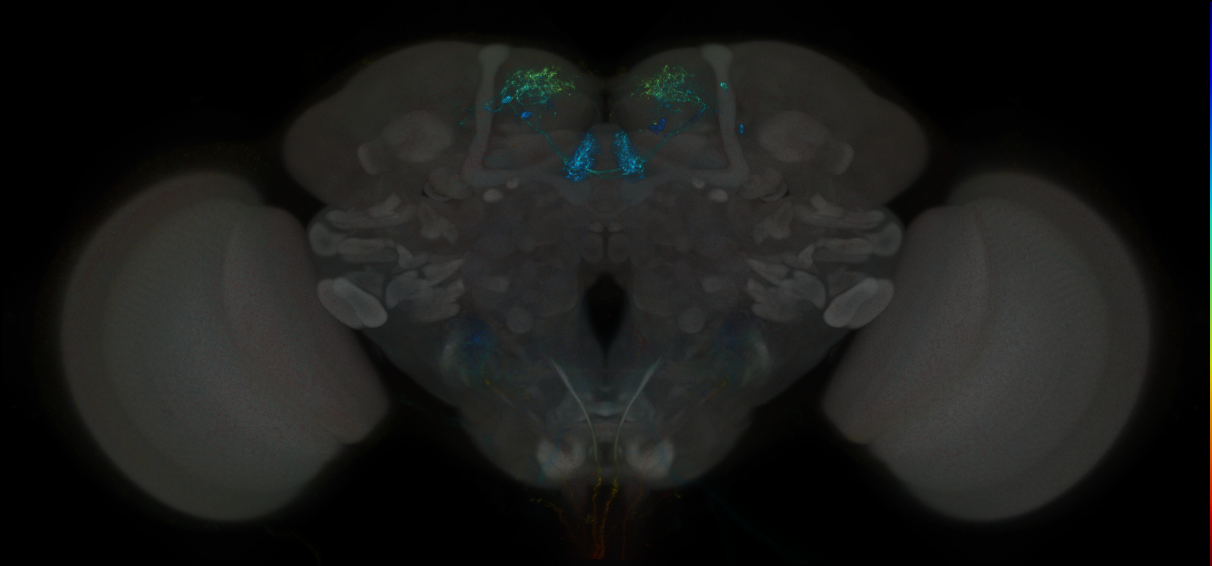 JRC_MB313B_Brain_2014_20121204_32_C3_20x