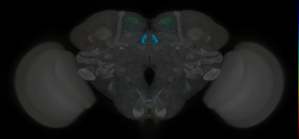 JRC_MB315C_Brain_2014_20121204_32_F1_20x