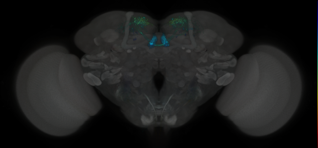 JRC_MB315C_Brain_2014_20121204_32_F2_20x