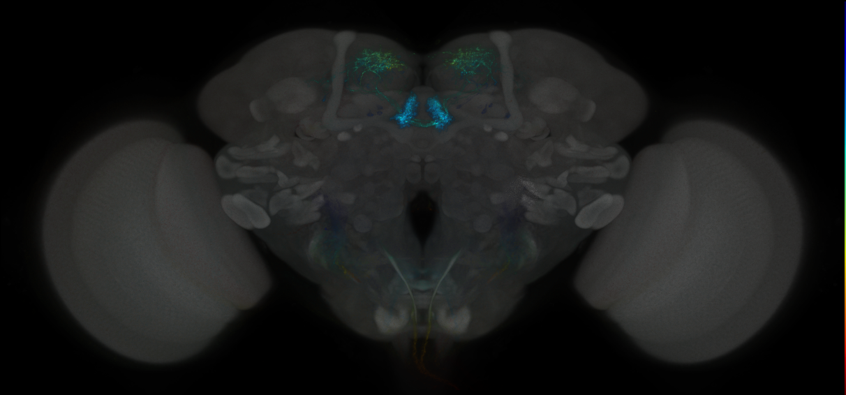 JRC_MB315C_Brain_2014_20121204_32_F3_20x