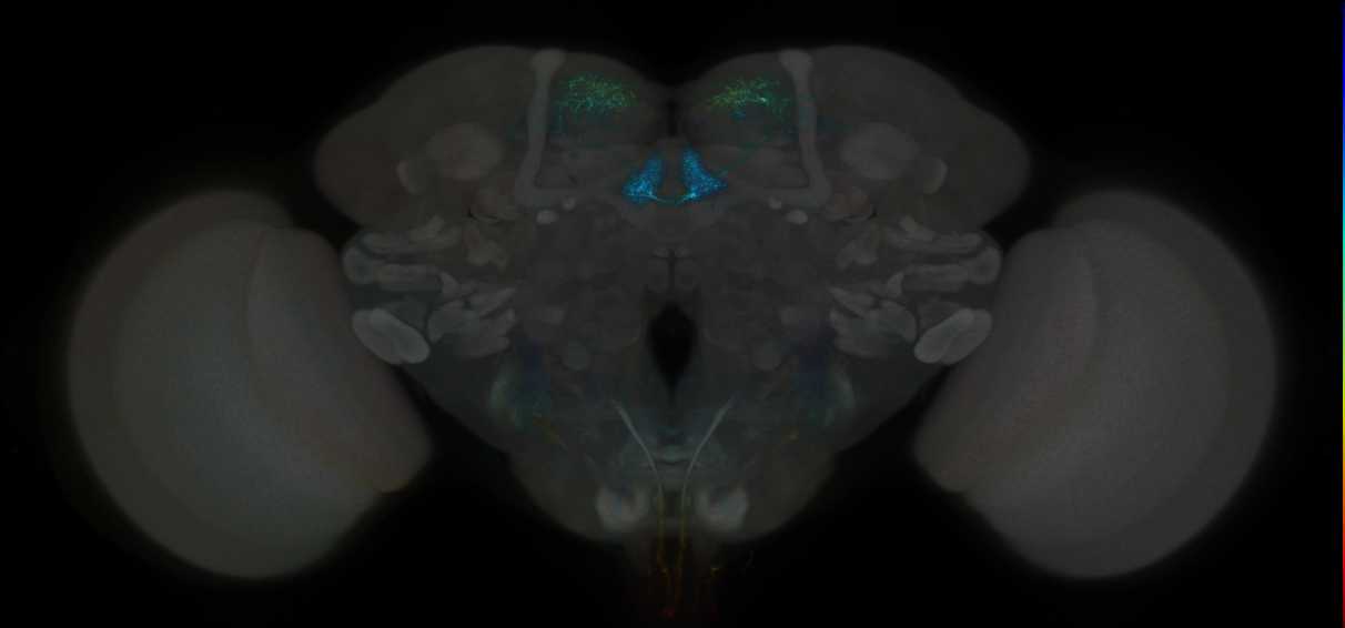 JRC_MB315C_Brain_2014_20121204_32_F4_20x
