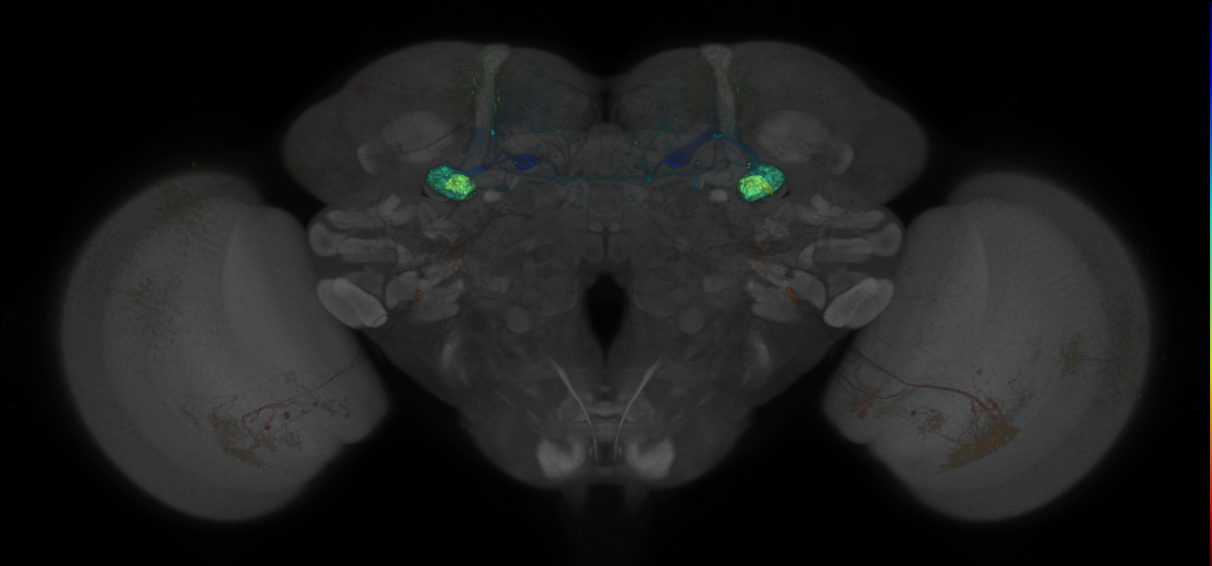 JRC_MB262B_Brain_2014_20130117_32_E2_20x