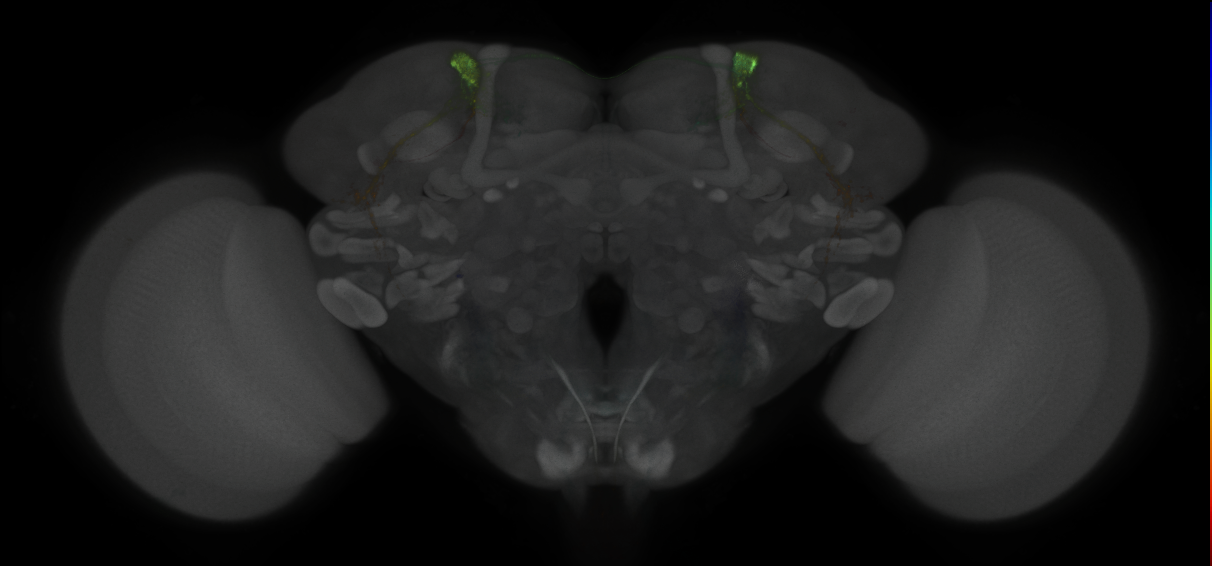 JRC_MB027B_Brain_2014_20121016_31_E2_20x