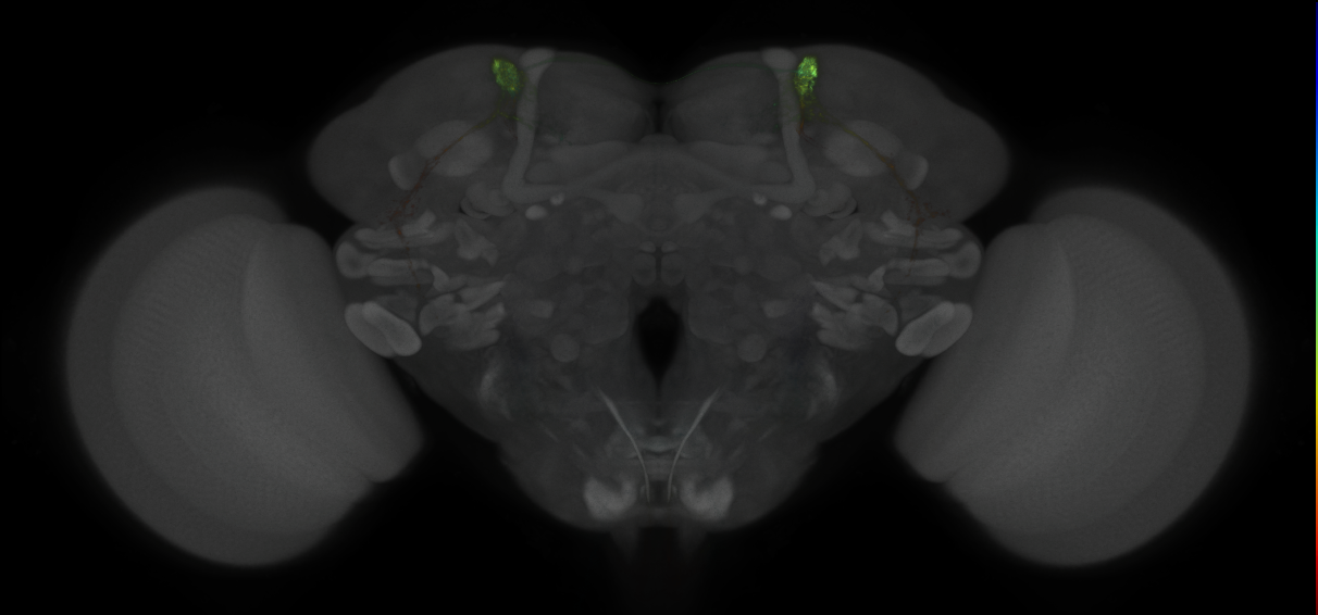 JRC_MB027B_Brain_2014_20121016_31_E3_20x