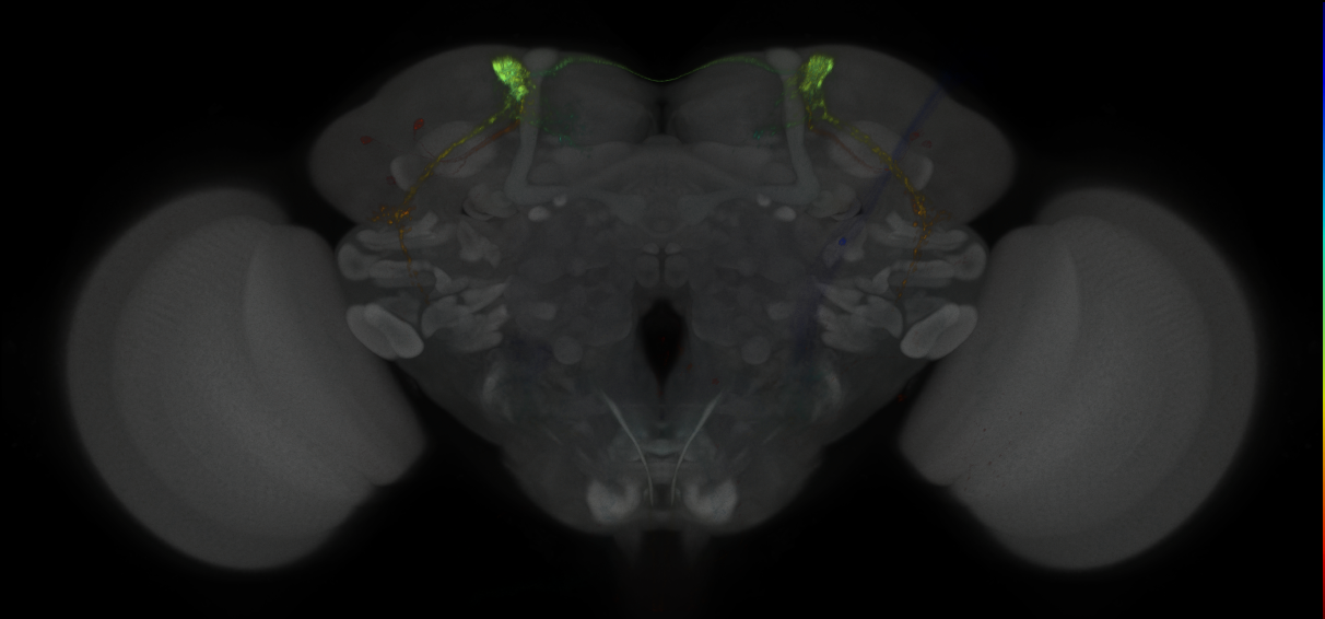 JRC_MB027B_Brain_2014_20121016_31_F1_20x