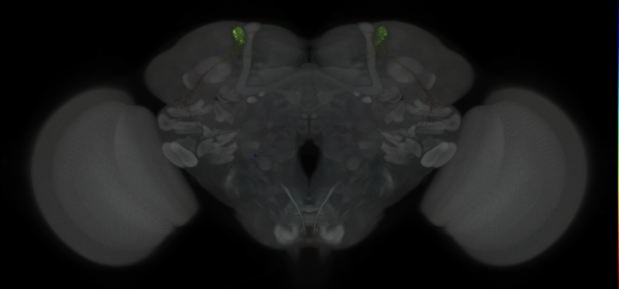 JRC_MB027B_Brain_2014_20121016_31_F3_20x