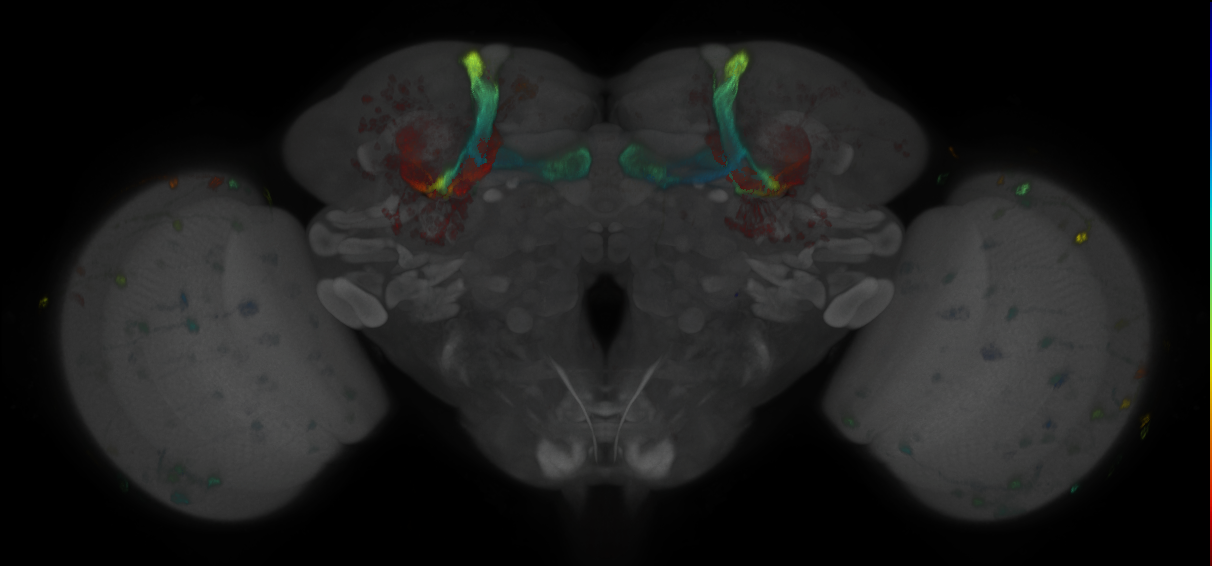 JRC_MB418B_Brain_2014_20121018_32_B1_20x