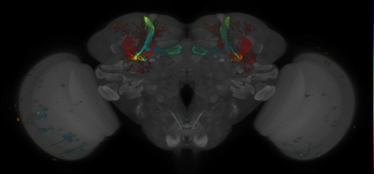 JRC_MB418B_Brain_2014_20121018_32_B2_20x
