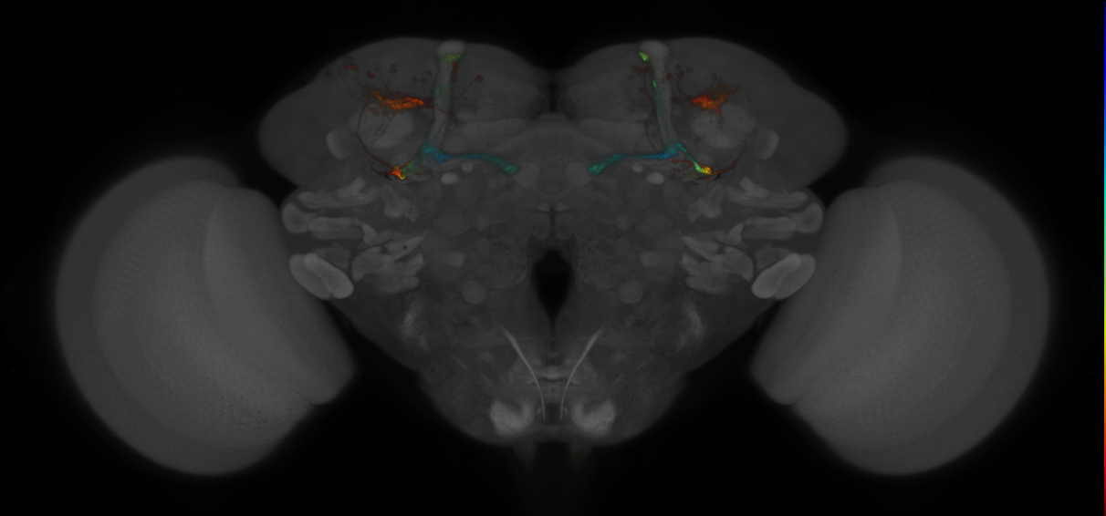 JRC_MB371B_Brain_2014_20121018_32_E1_20x