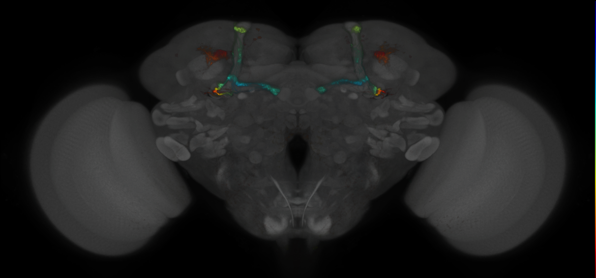 JRC_MB371B_Brain_2014_20121018_32_E3_20x