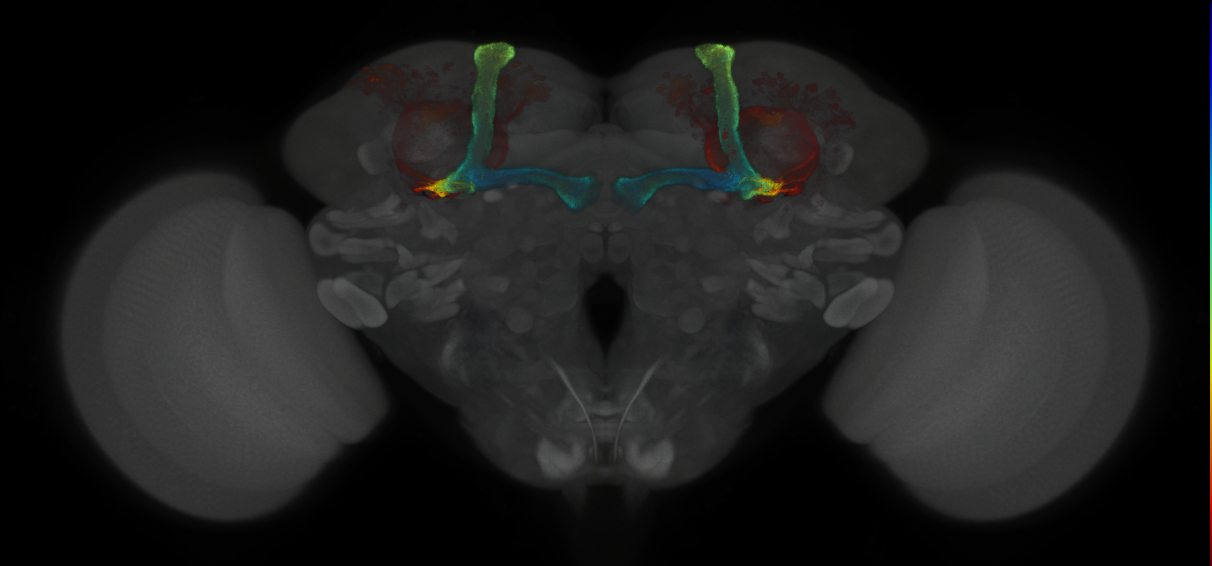 JRC_MB477B_Brain_2014_20121018_32_G1_20x