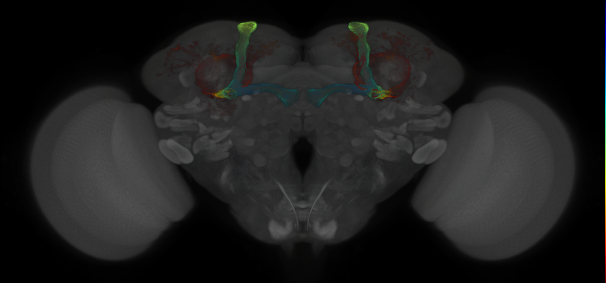 JRC_MB477B_Brain_2014_20121018_32_G2_20x