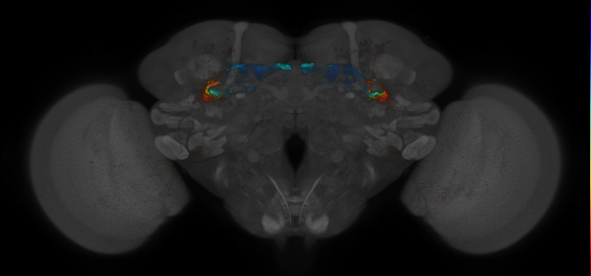 JRC_MB419B_Brain_2014_20121018_32_J2_20x