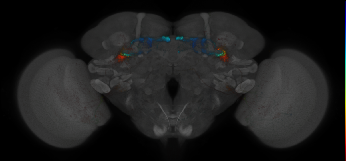 JRC_MB419B_Brain_2014_20121018_32_J3_20x