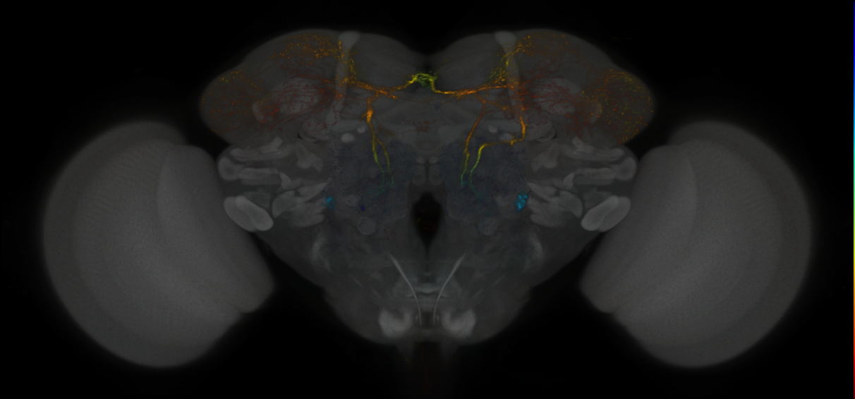 JRC_MB465C_Brain_2014_20121018_33_E1_20x