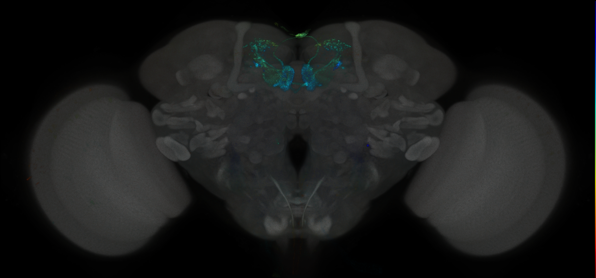 JRC_MB210B_Brain_2014_20121031_32_D3_20x