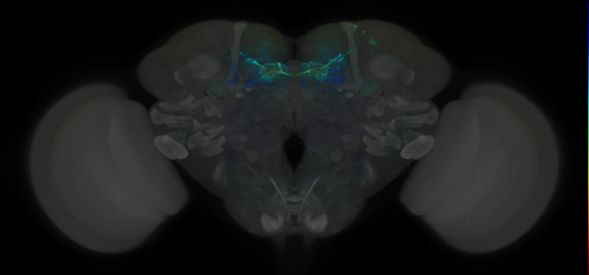JRC_MB042B_Brain_2014_20121001_31_A2_20x