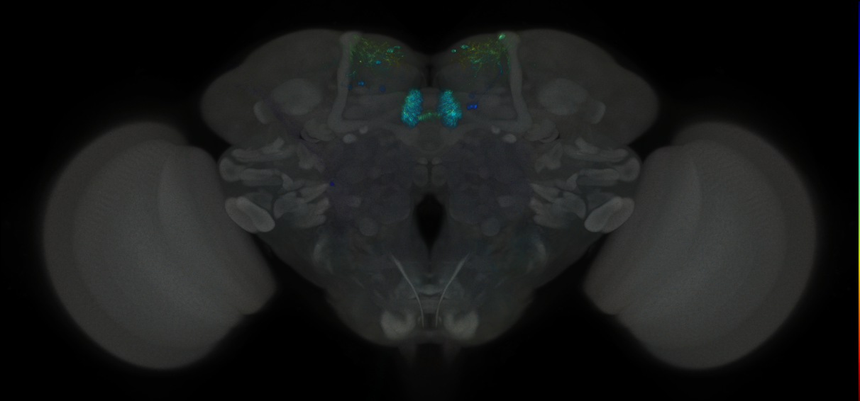 JRC_MB315C_Brain_2014_20121001_31_D4_20x