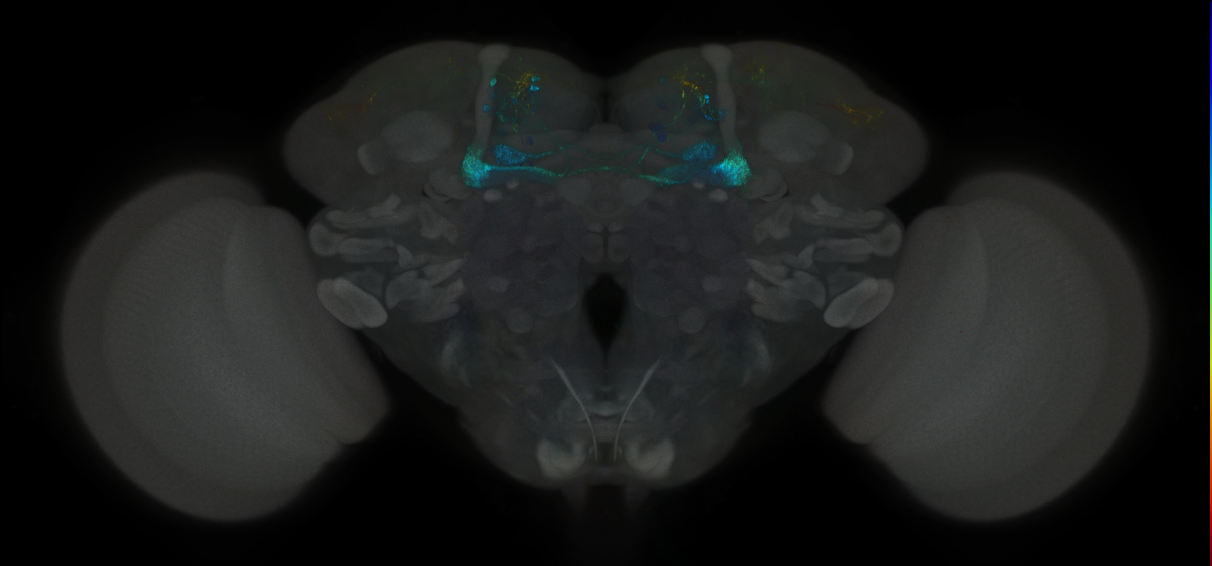 JRC_MB043B_Brain_2014_20121001_31_E1_20x