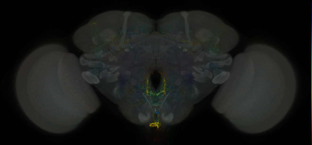 JRC_MB021B_Brain_2014_20121001_31_H2_20x