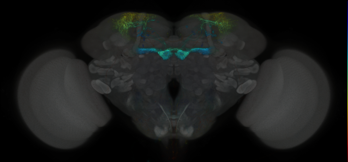 JRC_MB213B_Brain_2014_20121019_32_A2_20x