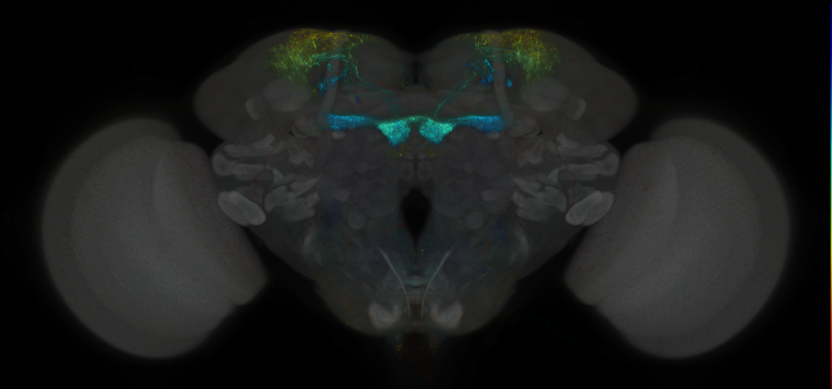 JRC_MB213B_Brain_2014_20121019_32_A5_20x