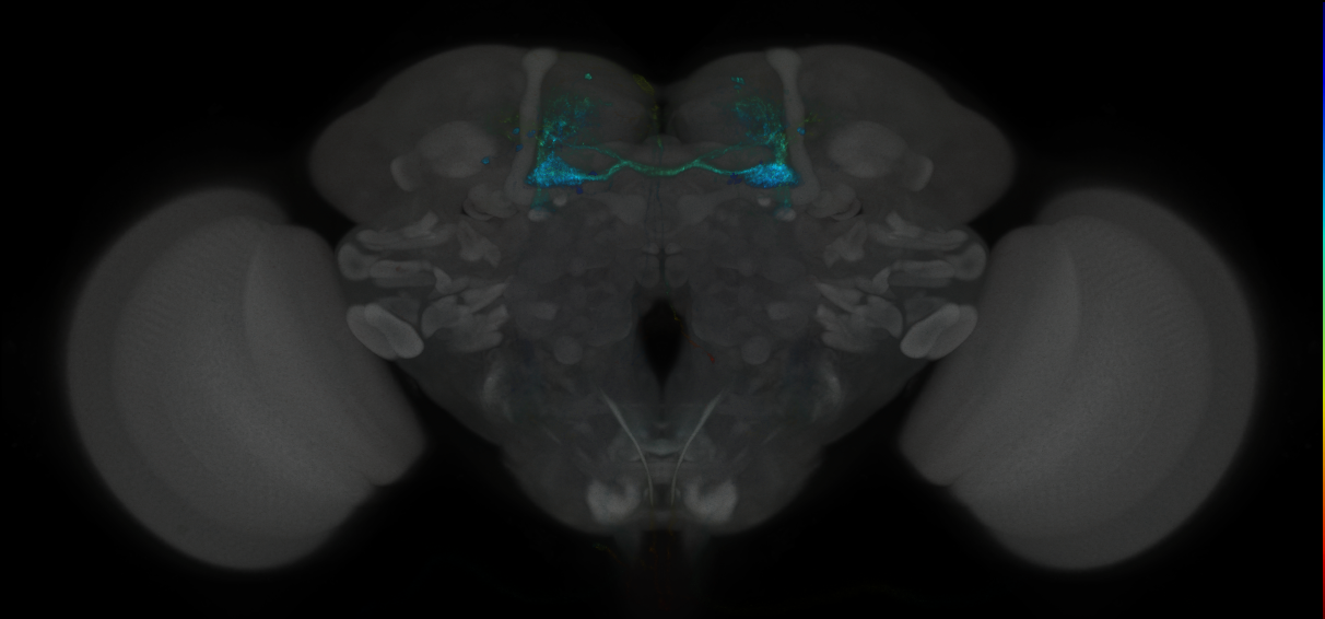 JRC_MB025B_Brain_2014_20121019_32_D2_20x