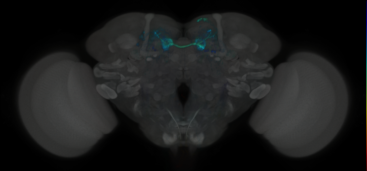 JRC_MB312B_Brain_2014_20121019_32_F2_20x