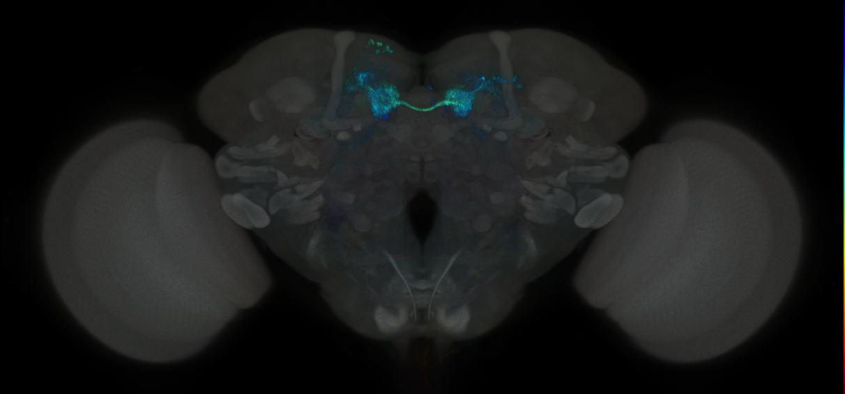 JRC_MB312B_Brain_2014_20121019_32_F5_20x