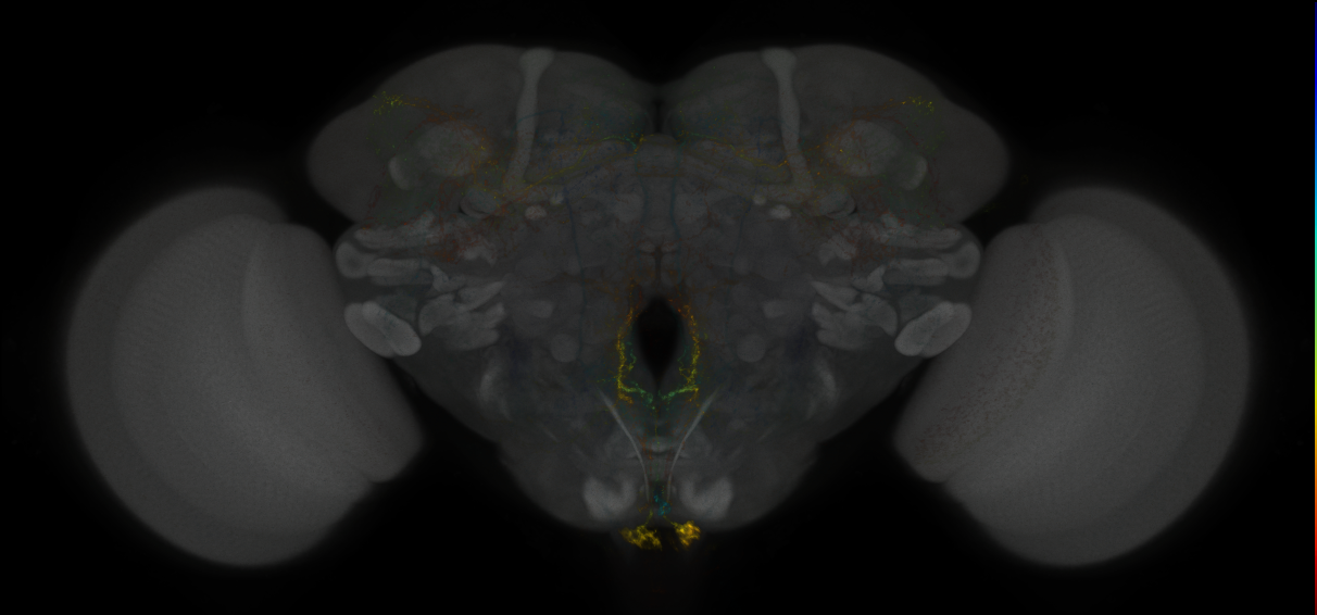 JRC_MB021B_Brain_2014_20121023_31_C1_20x