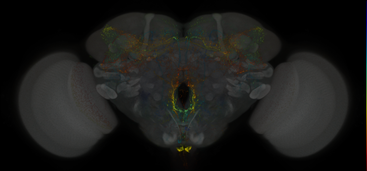 JRC_MB021B_Brain_2014_20121023_31_C3_20x