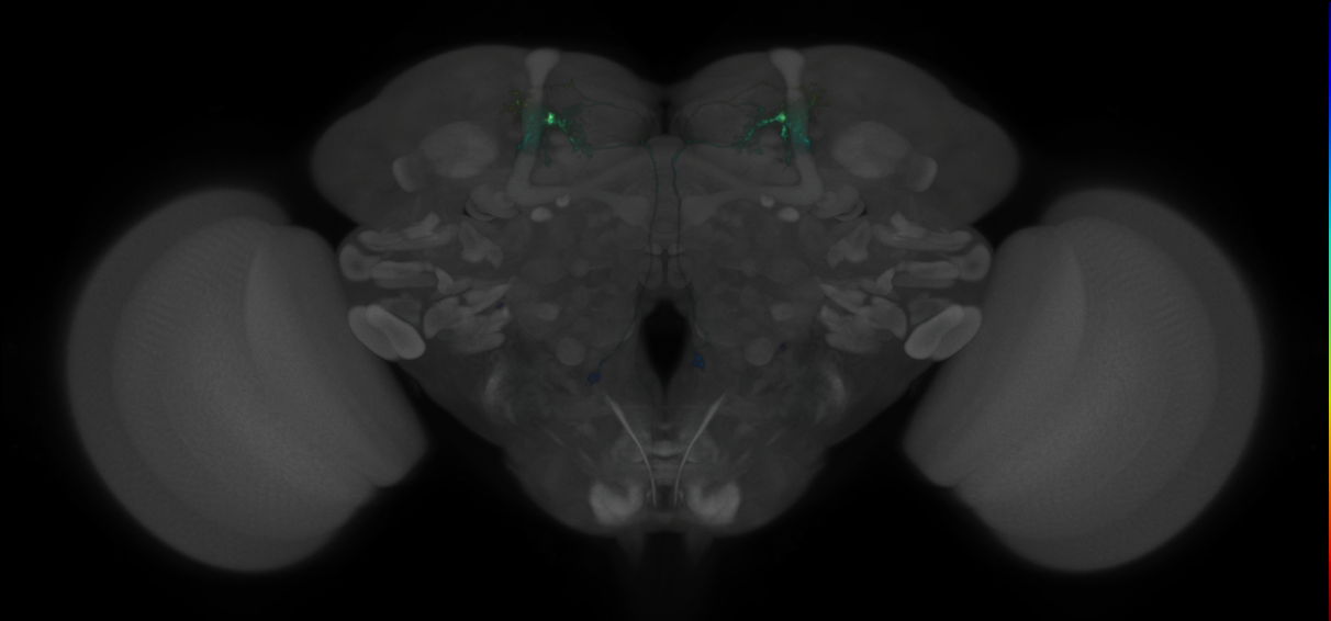 JRC_MB018B_Brain_2014_20121119_31_A2_20x