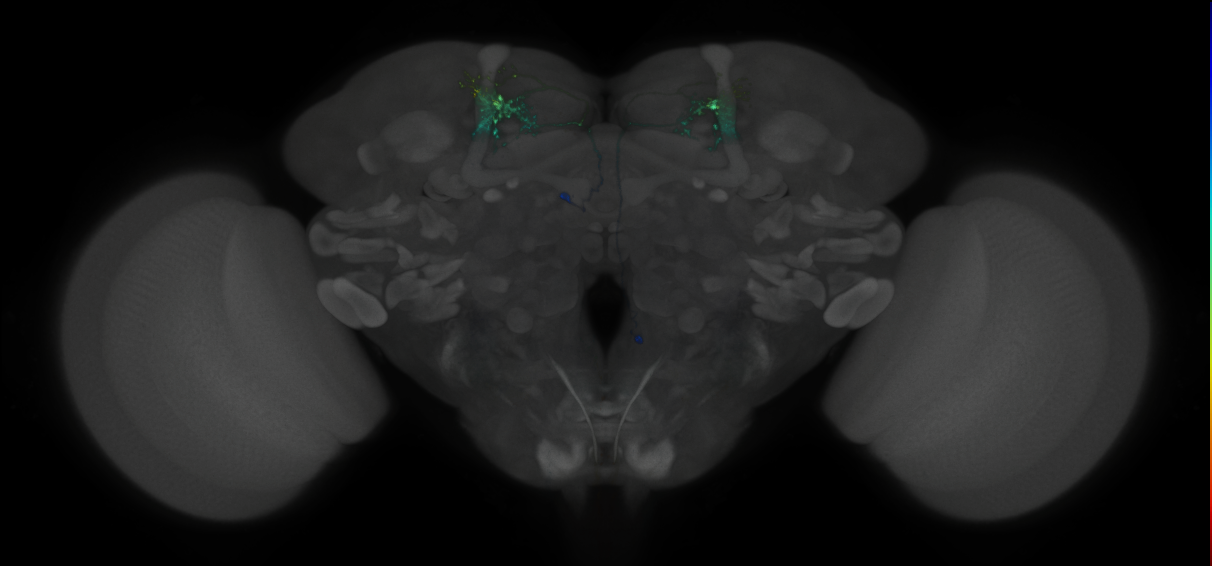 JRC_MB018B_Brain_2014_20121119_31_A3_20x