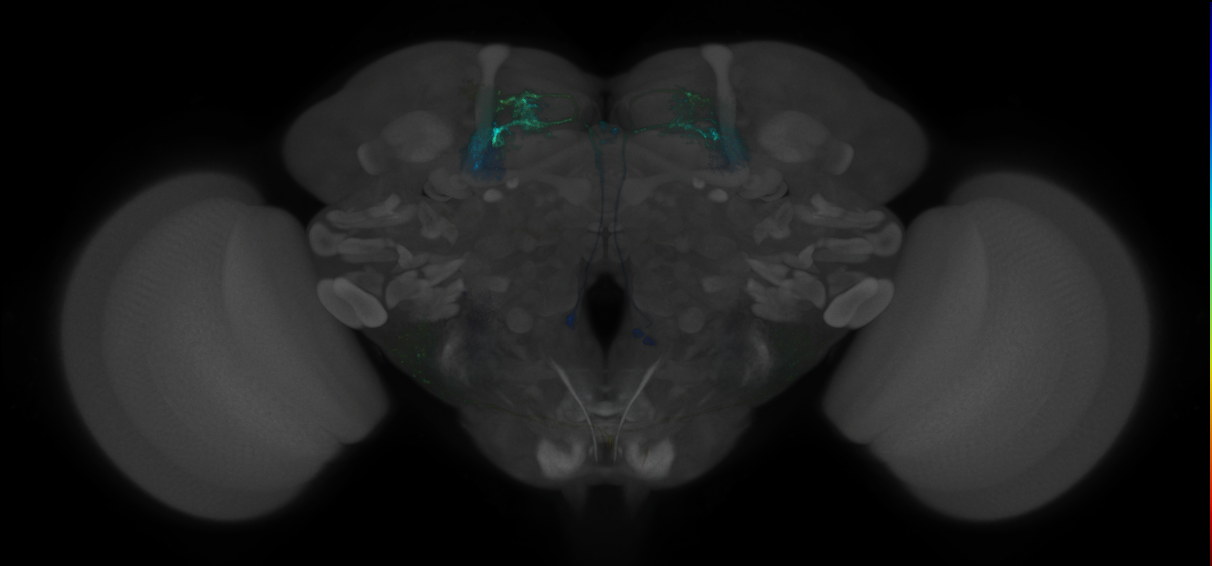 JRC_MB051C_Brain_2014_20121119_31_F4_20x