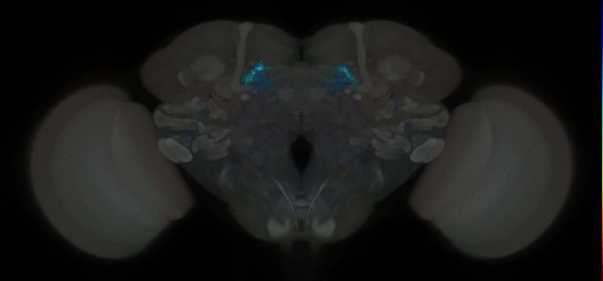 JRC_MB110C_Brain_2014_20121123_32_H6_20x