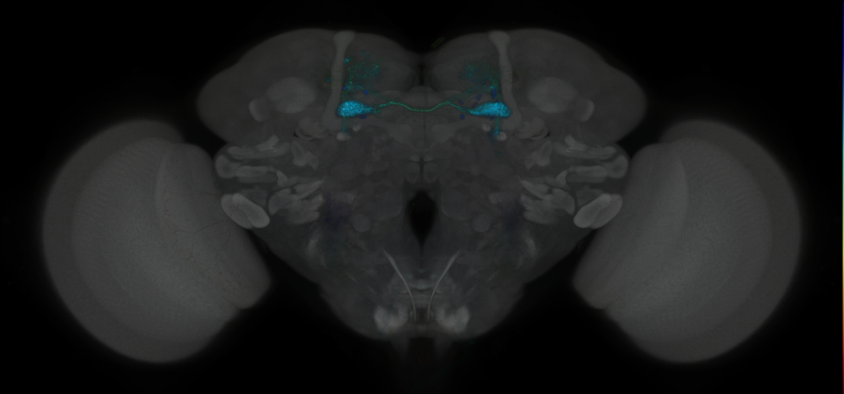 JRC_MB025B_Brain_2014_20121126_31_A1_20x