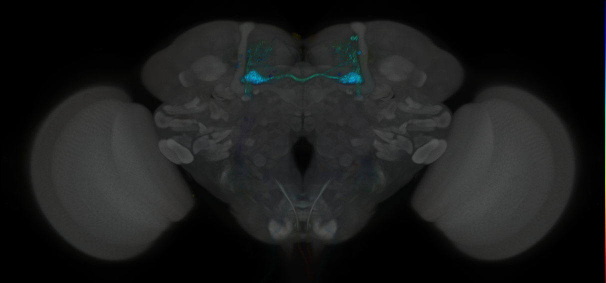 JRC_MB025B_Brain_2014_20121126_31_A3_20x