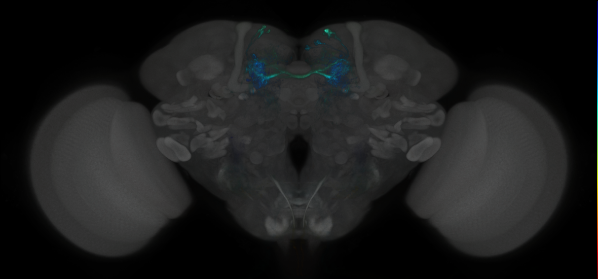 JRC_MB441B_Brain_2014_20121126_33_F1_20x