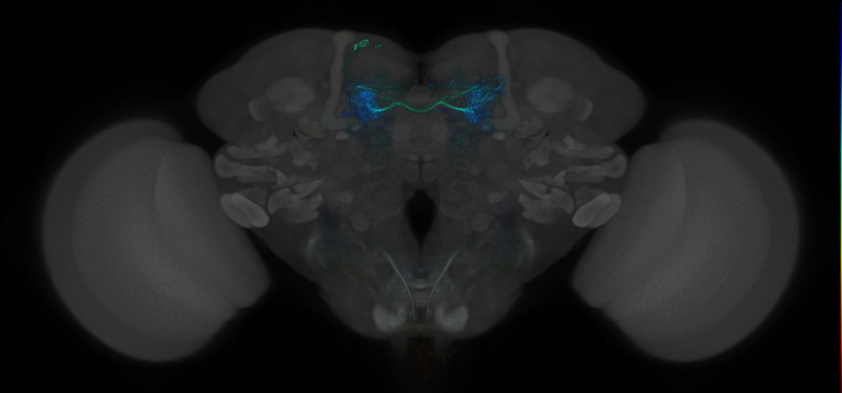 JRC_MB441B_Brain_2014_20121126_33_F2_20x