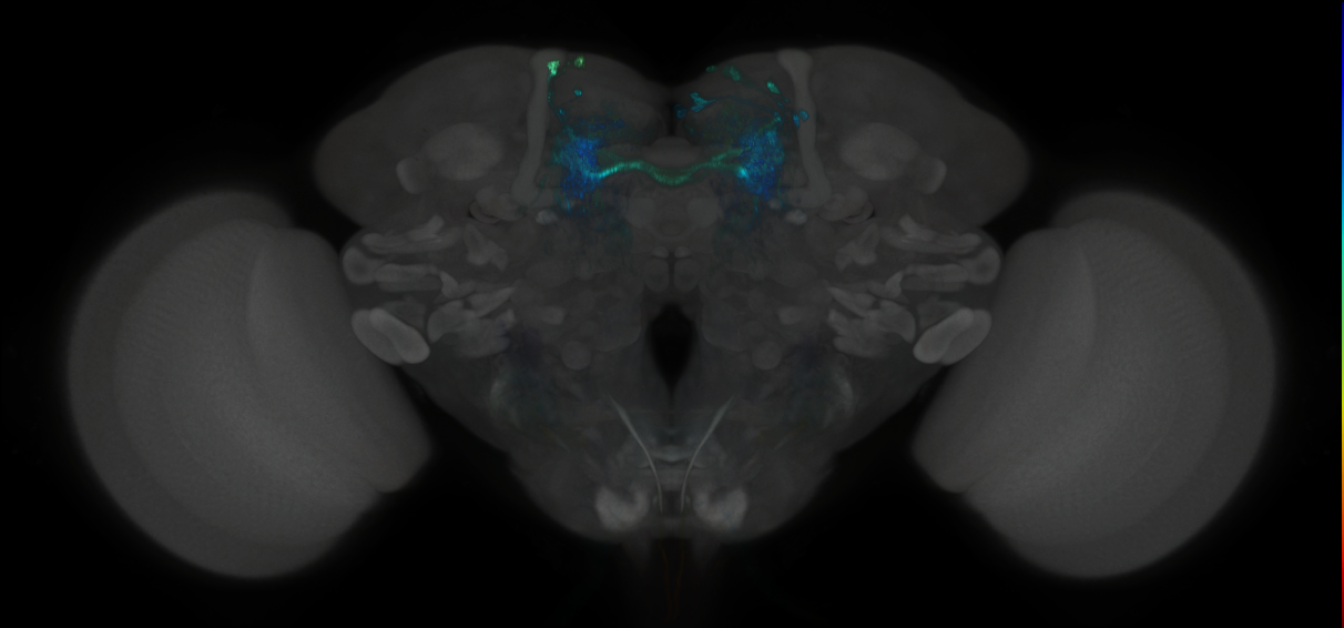 JRC_MB441B_Brain_2014_20121126_33_F5_20x