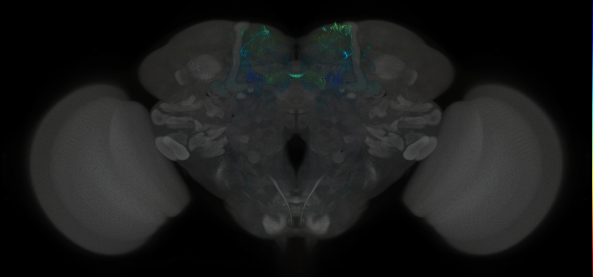 JRC_MB196B_Brain_2014_20121018_34_B1_20x
